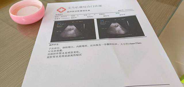 苏州二代代孕的费用，南京第三代试管代孕儿童医院排名？试管婴儿-ET机构列表