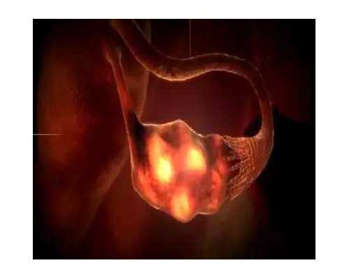 孕妇孕期长痘痘怎么办孕期痘痘怎么调理，长痘痘吃什么