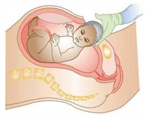 代孕一个多月感冒发烧吃药打针对胎儿影响大吗