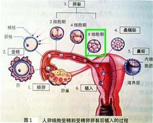 代孕医学-代孕妻子的双胞胎-子宫内膜息肉会癌变