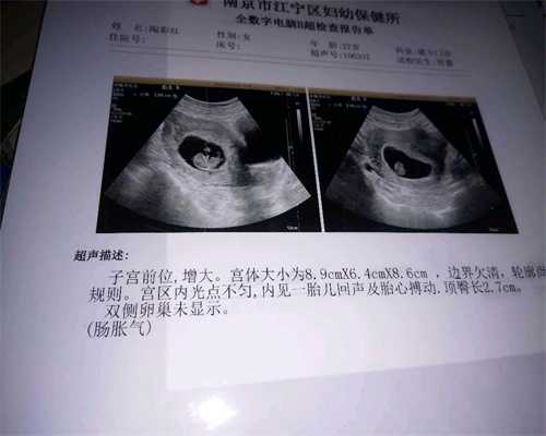 北京哪家做代孕试管好,北京三代试管婴儿选性别