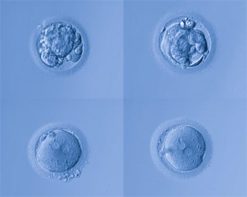 代怀孕诺贝尔-卵巢早衰借卵试管可以吗代孕天天