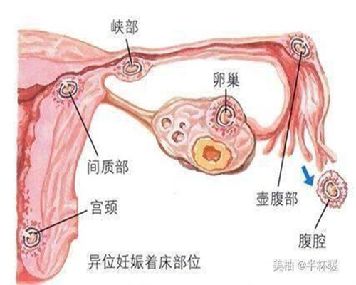 靠谱世纪代怀孕包男孩-中国代孕妈妈什么时候合