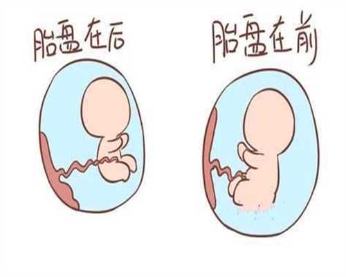 先天性卵巢发育不全来月经,代孕协议女性尿路感