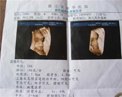 南京供卵试管后悔了南京郑州代代孕代孕价格表