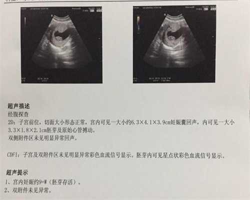 南京代孕生子_南京代孕的医院_南京代孕成功率是