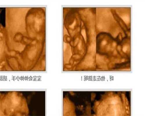 南京代孕-南京专业代孕价格-南京合法代孕花多少