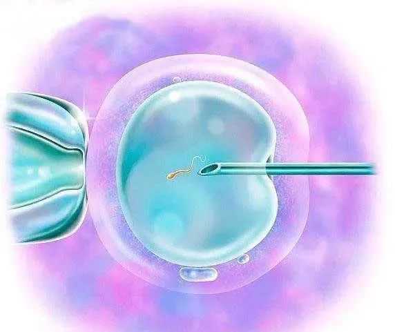 2022年贵阳供卵试管能包生男孩的医院名单